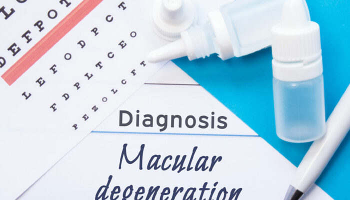 Key things to know about macular degeneration